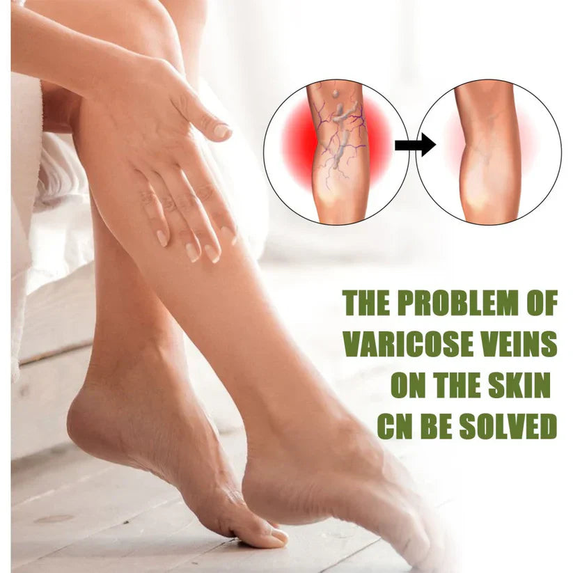 MEDix™ Varicose Veins Spray