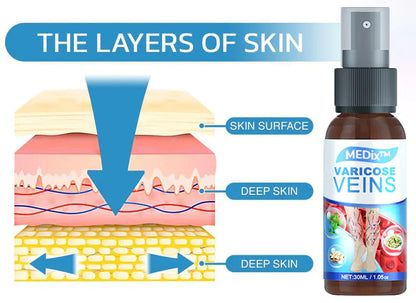 MEDix™ Varicose Veins Spray