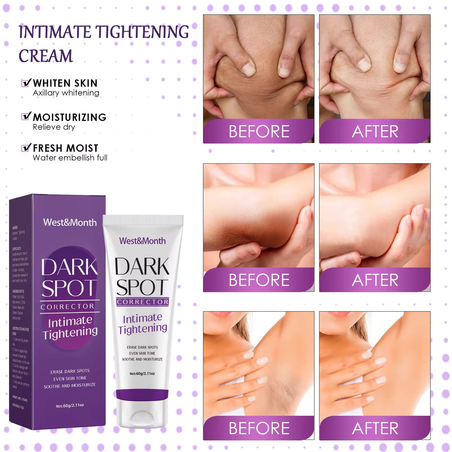 Dark Spot Corrector - Intimate Tightening Cream